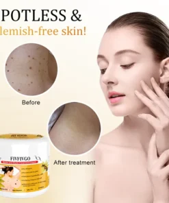 Fivfivgo™ Bee Venom Mole and Wart Treatment Cream