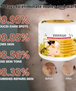Fivfivgo™ Bee Venom Mole and Wart Treatment Cream