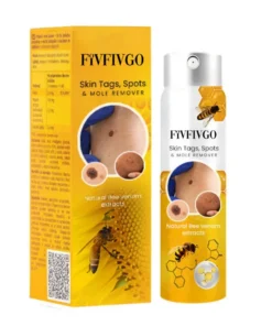 Fivfivgo™ Skin Tags, Spots & Mole Remover