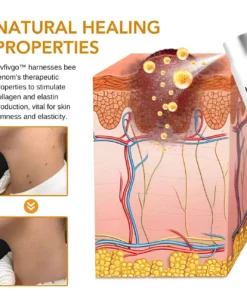 Fivfivgo™ Skin Tags, Spots & Mole Remover