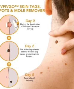 Fivfivgo™ Skin Tags, Spots & Mole Remover