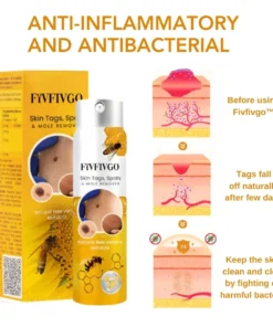 Fivfivgo™ Skin Tags, Spots & Mole Remover