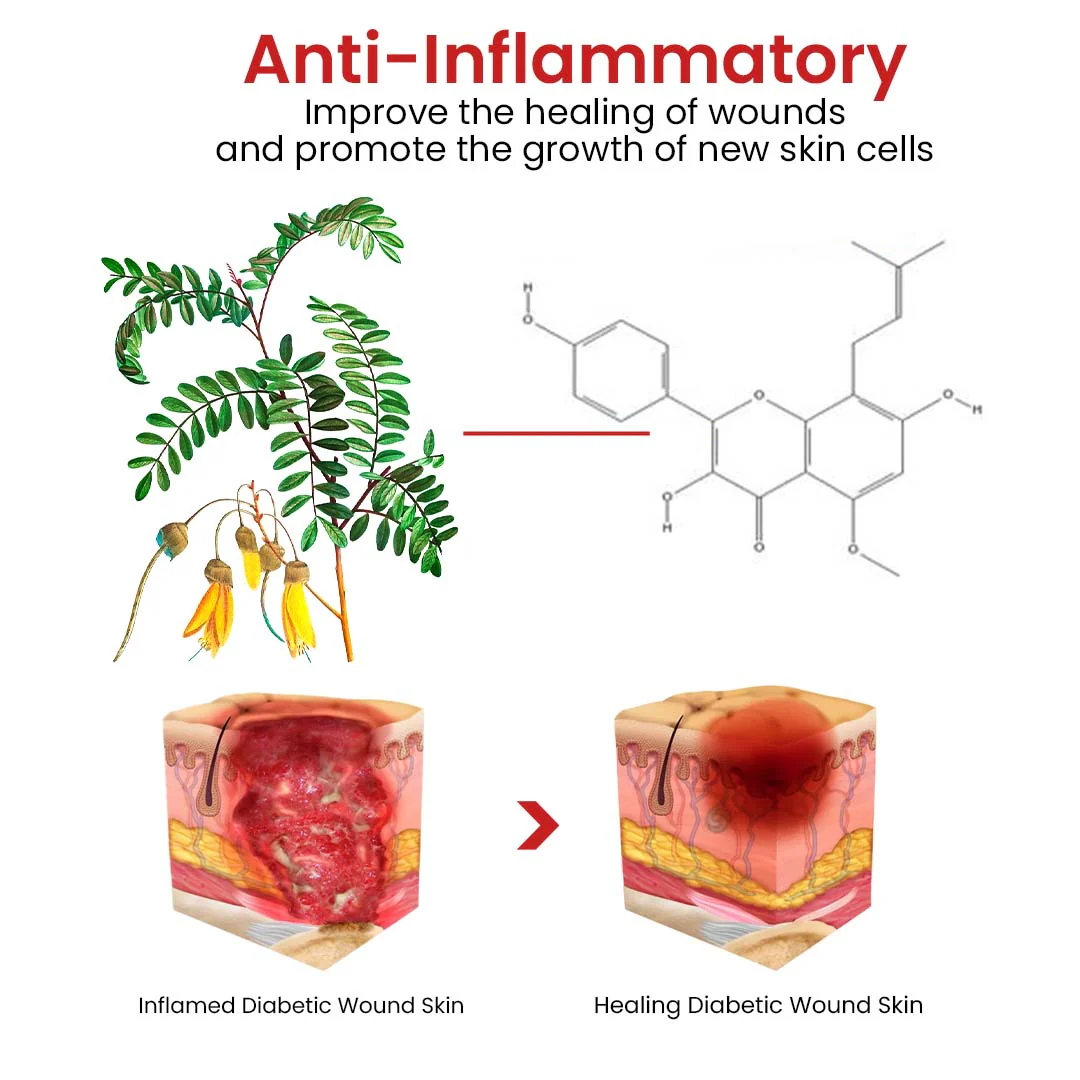 Flycare™ Fast Healing Diabetic Wound Ointment