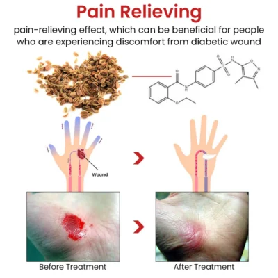 Flycare™ Fast Healing Diabetic Wound Ointment