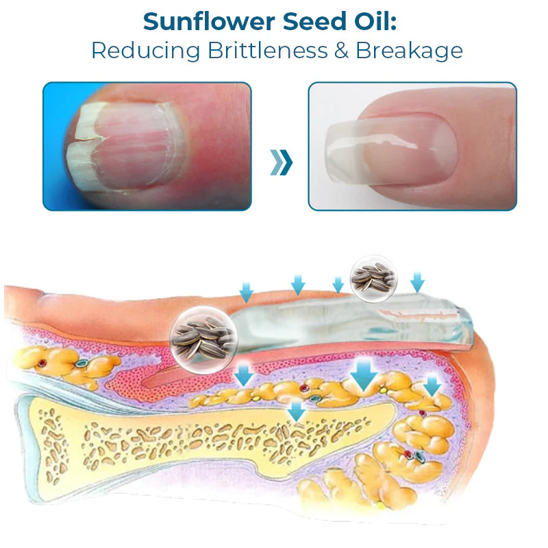 Furzero™ Alyssa Natural Gel Nail Polish Remover