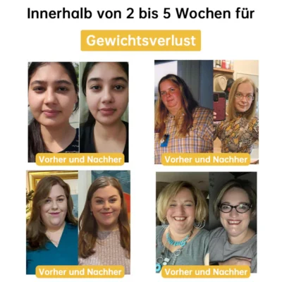 Furzero™ Bienengift Entgiftungs-Schlankheitspflaster