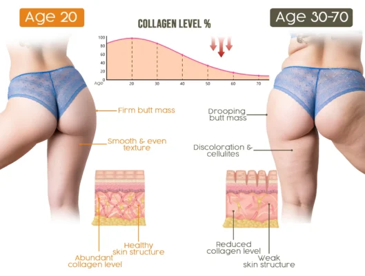 Furzero™ Brazilian Bewtie Bee Venom Body Butter