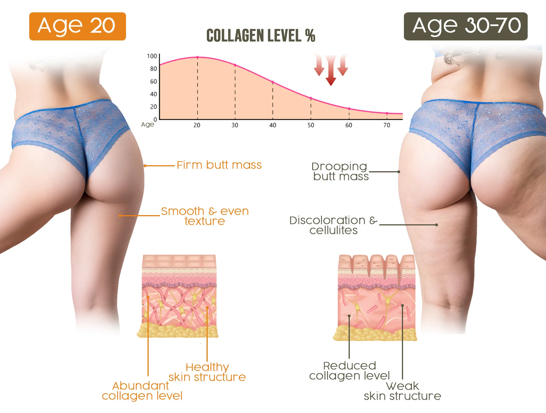 Furzero™ Brazilian Bewtie Bee Venom Body Butter