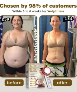 Furzero™ EMS Ultrasonic Far Infrared Anti-Cellulite Massager