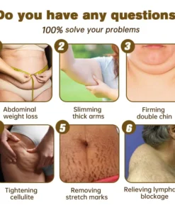 Furzero™ EMS Ultrasonic Far Infrared Anti-Cellulite Massager