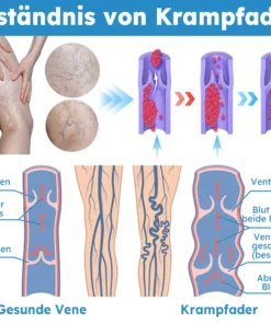 Furzero™ Escin Krampfader-Spray