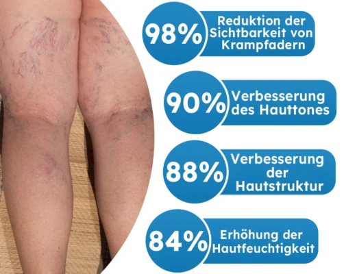 Furzero™ Escin Krampfader-Spray