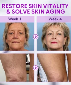 Furzero™ Hyaluronic Age-Defy Cream