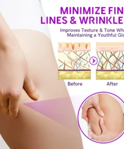 Furzero™ Hyaluronic Age-Defy Cream