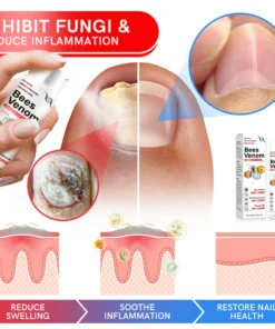 Furzero™ Multi-Symptom Bee Venom Psoriasis Treatment Spray