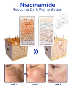 Furzero™ NonSpot Bee Venom Pigment Correction Cream