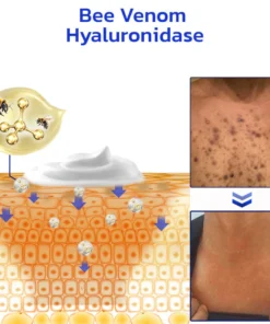 Furzero™ NonSpot Bee Venom Pigment Correction Cream