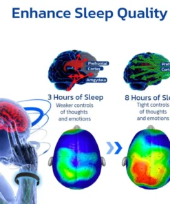 Furzero™ NumbMend Graphene Bracelet