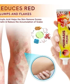 Furzero™ PsoriaCare Psoriasis Treatment Cream