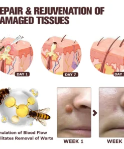 Furzero™ TagFree And Moles Remover