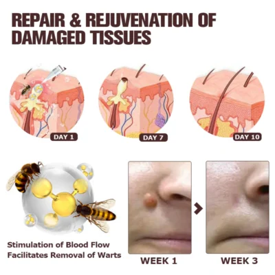 Furzero™ TagFree And Moles Remover