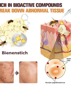 Furzero™ TagFree And Moles Remover