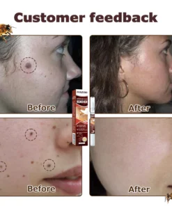 Furzero™ TagFree And Moles Remover