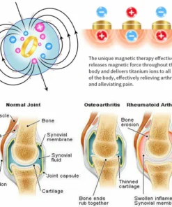 Futusly™ - Cat's Eye Ring for Lymphatic Magnetic Therapy