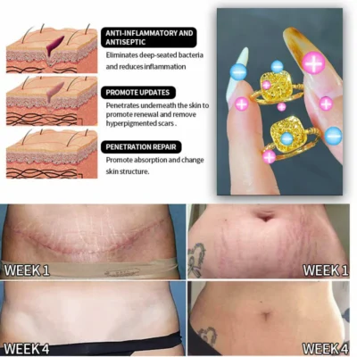 Futusly™ Lymphatische Magnettherapie Goldring