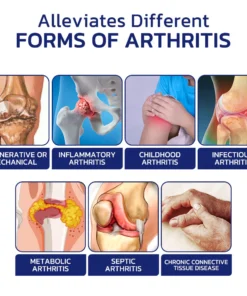 GFOUK™ Beelief Bee Venom Joint And Bone Therapy Cream