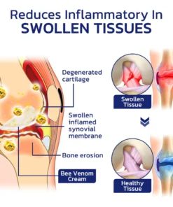 GFOUK™ Beeliefe Bee Venom Joint And Bone Therapy Cream