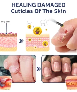 GFOUK™ Comfrey Healing 7 Days Growth And Strengthened Nail Serum