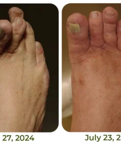 GFOUK™ CroCare Crocodile Oil Joint Therapy Balm