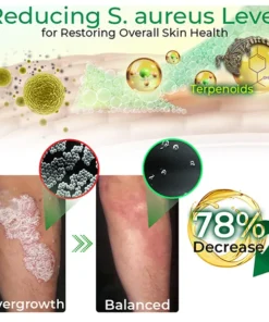 GFOUK™ Crócil Crocodile Oil Repair Aleppo Soap