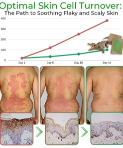 GFOUK™ Crócil Crocodile Oil Repair Aleppo Soap