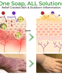 GFOUK™ Crócil Crocodile Oil Repair Aleppo Soap