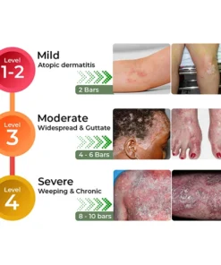 GFOUK™ Crócil Crocodile Oil Repair Aleppo Soap