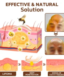 GFOUK™ Maryann Bee Venom Lymphatic Recovery Cream