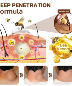 GFOUK™ Maryanni Bee Venom Lymphatic Recovery Cream