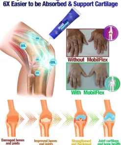 GFOUK™ MobilFlex Jellyfish Collagen Joint Repair Cream