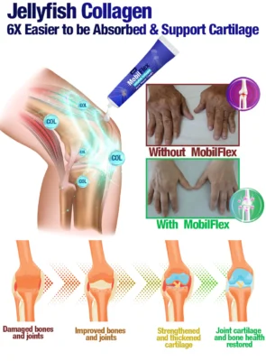 GFOUK™ MobilFlex Jellyfish Collagen Joint Repair Cream