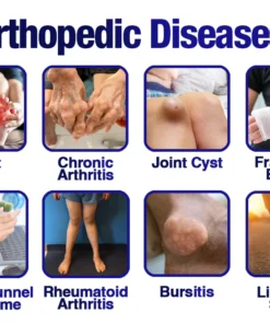 GFOUK™ MobilFlex Jellyfish Collagen Joint Repair Cream