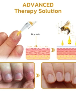 GFOUK™ NailPlus Strong Bee Venom 7 Days Growth Nail Gel