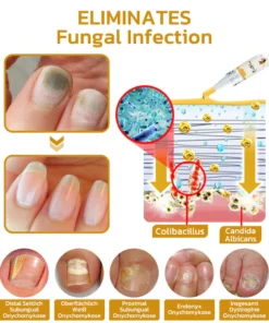 GFOUK™ NailPlus Strong Bee Venom 7 Days Growth Nail Gel