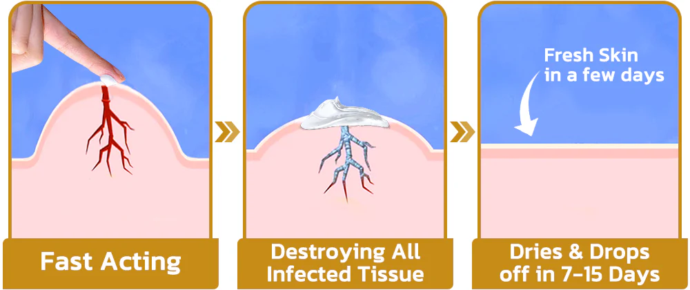 GFOUK™ TakeTag Bee Venom Therapy Cream