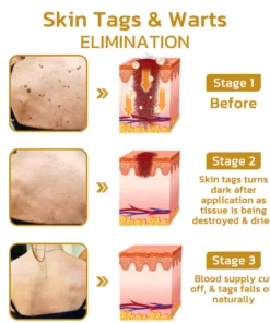 GFOUK™ TakeTag Bee Venom Therapy Cream