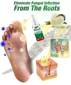 GFOUK™ Tineasil Athlete's Foot Crocodile Oil Treatment Spray