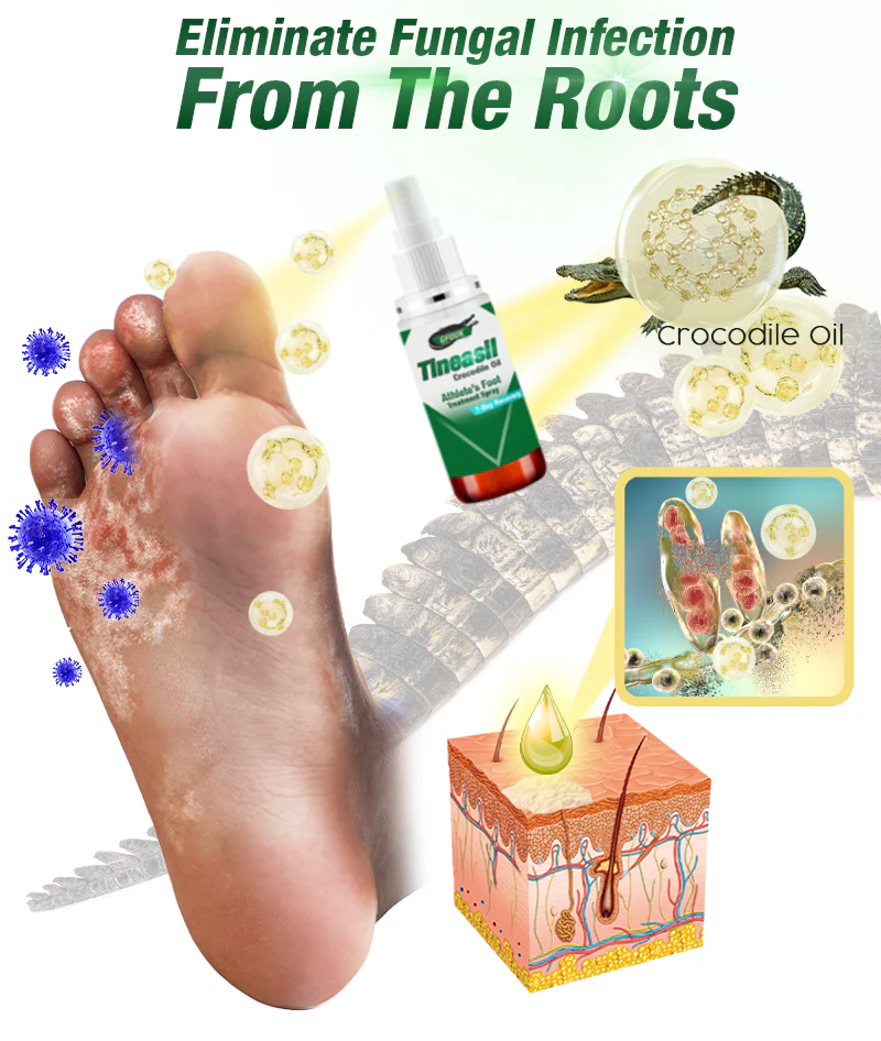GFOUK™ Tineasil Athlete's Foot Crocodile Oil Treatment Spray