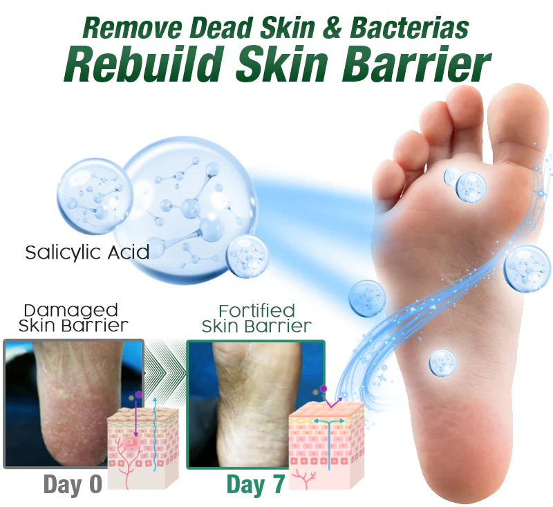 GFOUK™ Tineasil Athlete's Foot Crocodile Oil Treatment Spray