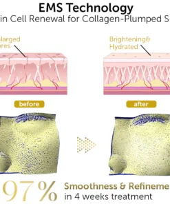 GFOUK™ Vline EMS 360 Wand